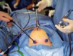 gallbladder surgery