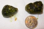 1st Liver Flush Largest Stones