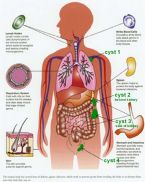 Kidney cyst more1 ... (Click to enlarge)