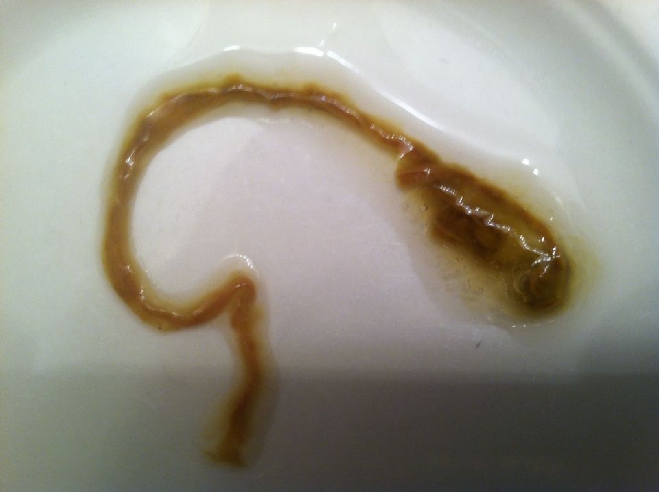 Tapeworm In My Stool On CureZone Image Gallery