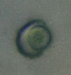 Unknown Face Parasite Green Round Egg Inside Hard Egg Shell Casing (Top Half Missing) .1mm - 400X Image