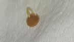 Parasite worm egg or sac