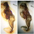 Face Skin Parasite. Worm? Fluke Larvae? One of Many Similar 400X Two Diff Lighting Photos of Same Sample