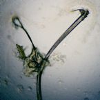 Face Worm Parasite - 8mm Total - Photo of End Section Detail With Appendage