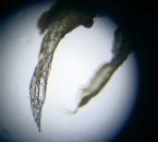 2mm Face Parasite Flat Worm Larvae Hook at End (Blurred) Unknown Species 100X