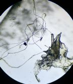 Face Parasite Worms Fibers and Other