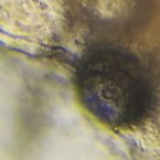 Closeup face worm parasite hatching from ova 400x image enhanced