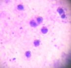 duplicating purple nuclei