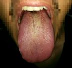 tongue test