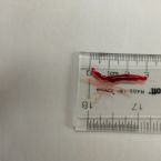 Blood Sucker from Sinus - Tapeworm?