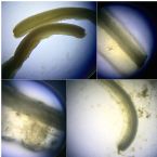 Intestinal Worm Parasite - What Is It? Hook Worm?