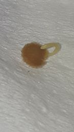 Parasite worm egg or sac