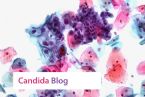 candida blog pap smear yeast infection