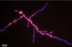 candida-chitin-fluorescence