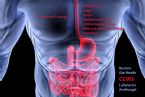 causes of candida lufenuron ccws