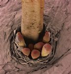 eyelash mites ... (Click to enlarge)