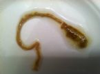 tapeworm in my stool ... (Click to enlarge)