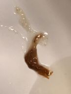 parasite or worm identification please