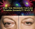 Unique Opportunity: Lose Under-Eye Bags Instantly. WATCH!!! InstantlyAgeless.UK