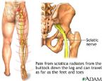 sciaticnerveskeletal