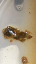 Another type of parasite i found