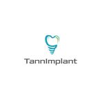 tannimplant