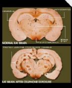 rat brain