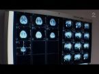 Eilerts Brain Scan