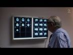 Eilerts Brain Scan John