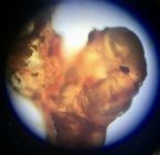 Microscopic Photo Parasite Skin Cyst Larva Worm Fluke Morgellons Disease - What Is This? 9