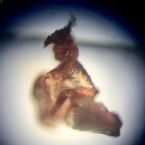 Microscopic Photo Parasite Skin Cyst Larva Worm Fluke Morgellons Disease - What Is This? 8