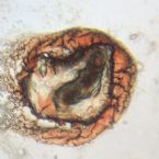 Microscopic Photo Parasite Skin Cyst Larva Worm Fluke Morgellons Disease - What Is This? 3