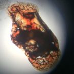 Microscopic Photo Parasite Skin Cyst Larva Worm Fluke Morgellons Disease - What Is This? 6