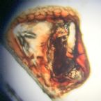 Microscopic Photo Parasite Skin Cyst Larva Worm Fluke Morgellons Disease - What Is This? 5