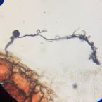 Microscopic Photo Parasite Face Filament Attached ... (Click to enlarge)