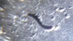 20160130 - larva present in fluid on arm sample