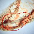 Identification request for Unknown Parasite and egg sac - Mite? Came from under skin on face - 400X Microscope photo.