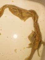 intestinal parasite specimen close up