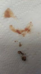 Parasite/Worm/Candida?