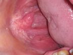 My throat ... (Click to enlarge)