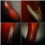 Unknown Skin Parasite sample 40X Unstained ... (Click to enlarge)