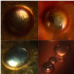 Unknown Skin Parasite Ova Examples incl Hatched/Hatching ... (Click to enlarge)