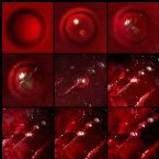 Skin Parasite Cyst / Ova Hatching Sequence Microbiology Microscopic Photo Montage ... (Click to enlarge)