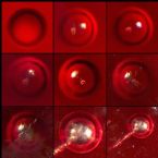 Microscopic Photos oc Round Skin Parasite OVA Hatching ... (Click to enlarge)