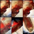 Skin Parasite Larvae Growth Sequence in Parasite Egg Sack, Cyst, or Cocoon. Hexapod? Flat Worm Playhelminth? Fluke Larvae? ... (Click to enlarge)