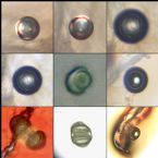 Skin Parasite Eggs Ova Photos Inside Outer Protective Round Shell ... (Click to enlarge)