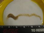 Parasite worm