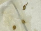 Parasites or gallstones after coffee enema? ... (Click to enlarge)