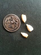 What are these seed like things found in my stool ... (Click to enlarge)