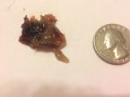 Help!!! Are there parasites in my nasal mucus???? ... (Click to enlarge)